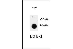 Dot blot analysis of anti-Phospho-ANTXR1-p Antibody (ABIN389986 and ABIN2839770) on nitrocellulose membrane. (ANTXR1 抗体  (pTyr425))