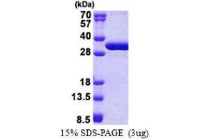 SDS-PAGE (SDS) image for Non-SMC Element 1 Homolog (NSMCE1) (AA 1-266) protein (His tag) (ABIN5853117)