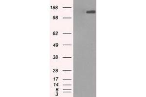 Image no. 1 for anti-L1 Cell Adhesion Molecule (L1CAM) antibody (ABIN1499083) (L1CAM 抗体)
