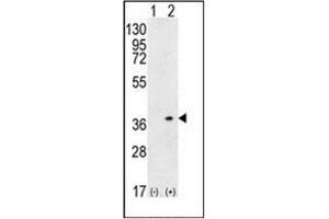 Western blot analysis of HLA-DQA1 (arrow) using HLA-DQA1 Antibody (N-term) Cat. (HLA-DQA1 抗体  (N-Term))