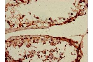 Immunohistochemistry of paraffin-embedded human testis tissue using ABIN7170106 at dilution of 1:100 (SLC15A3 抗体  (AA 253-309))