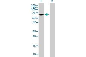 Western Blot analysis of PDE9A expression in transfected 293T cell line by PDE9A MaxPab polyclonal antibody. (PDE9A 抗体  (AA 1-533))