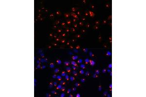 Immunofluorescence analysis of HeLa cells using SGMS1 Rabbit pAb (ABIN7270532) at dilution of 1:100. (Sphingomyelin Synthase 1 抗体  (AA 1-134))