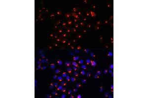 Immunofluorescence analysis of HeLa cells using SGMS1 Rabbit pAb (ABIN7270532) at dilution of 1:100. (Sphingomyelin Synthase 1 抗体  (AA 1-134))
