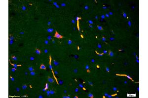 Immunofluorescence (IF) image for anti-ADAM Metallopeptidase with Thrombospondin Type 1 Motif, 7 (ADAMTS7) (AA 241-340) antibody (ABIN672486)
