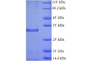 SDS-PAGE (SDS) image for Baculoviral IAP Repeat-Containing 5 (BIRC5) (AA 1-140), (full length) protein (His-SUMO Tag) (ABIN5709139) (Survivin Protein (AA 1-140, full length) (His-SUMO Tag))
