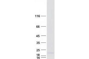 Western Blotting (WB) image for Ankyrin Repeat Domain 37 (ANKRD37) protein (Myc-DYKDDDDK Tag) (ABIN2714706)