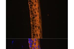 Immunofluorescence analysis of Rat eye using MYH13 Polyclonal Antibody at dilution of 1:100 (40x lens). (MYH13 抗体)