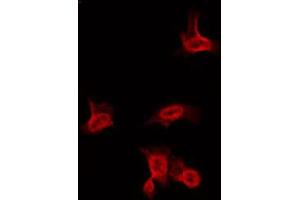ABIN6266636 staining HuvEc by IF/ICC. (Sodium Channel-Pan 抗体)