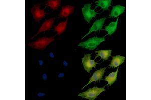 ABIN7095462 and ABIN7099519 staining  cells by IF/ICC. (FAM83B 抗体)