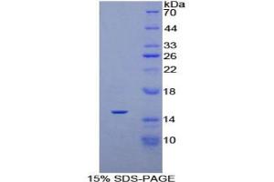 SDS-PAGE analysis of Rat PDGFAA Protein. (PDGF-AA Homodimer 蛋白)