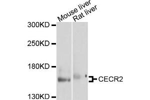 Western blot analysis of extracts of mouse liver and rat liver cells, using CECR2 antibody. (CECR2 抗体)