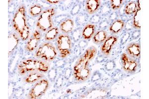Formalin-fixed, paraffin-embedded human Renal Cell Carcinoma stained with CD137L-Monospecific Mouse Monoclonal Antibody (CD137L/1547). (TNFSF9 抗体)