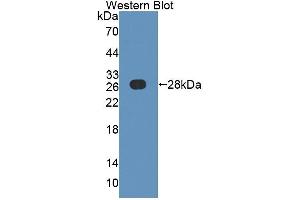 Western blot analysis of the recombinant protein. (AFAP 抗体  (AA 352-572))