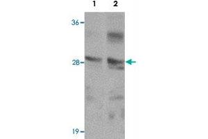 Western blot analysis of TMEM192 in SK-N-SH cell lysate with TMEM192 polyclonal antibody  at (1) 0. (TMEM192 抗体  (C-Term))