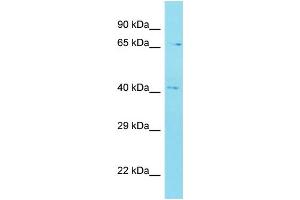 Host: Rabbit Target Name: C12orf56 Sample Type: MDA-MB-435S Whole Cell lysates Antibody Dilution: 1.