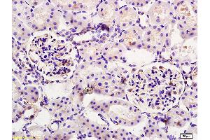 Immunohistochemistry (IHC) image for anti-Cytochrome P450, Family 11, Subfamily A, Polypeptide 1 (CYP11A1) (AA 321-420) antibody (ABIN701530)