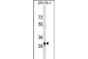 PED2 Antibody (C-term) (ABIN1536882 and ABIN2850012) western blot analysis in ZR-75-1 cell line lysates (35 μg/lane). (MPPED2 抗体  (C-Term))