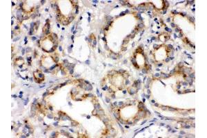 IHC analysis of Frizzled homolog 1 using anti-Frizzled homolog 1 antibody (ABIN3042412). (FZD1 抗体  (C-Term))