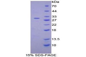 SDS-PAGE analysis of Mouse Integrin alpha D Protein. (ITGAD 蛋白)