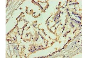 Immunohistochemistry (IHC) image for anti-Solute Carrier Family 27 (Fatty Acid Transporter), Member 4 (SLC27A4) (AA 494-643) antibody (ABIN7158496)