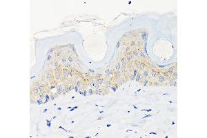 Immunohistochemistry of paraffin-embedded mouse skin using Involucrin Rabbit mAb (ABIN6128025, ABIN6141815, ABIN6141818 and ABIN7101419) at dilution of 1:100 (40x lens). (Involucrin 抗体)