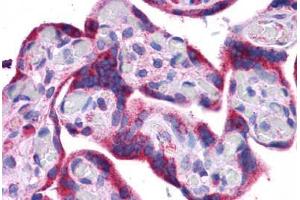 Human Placenta: Formalin-Fixed, Paraffin-Embedded (FFPE) (ATG5 抗体  (C-Term))