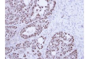 Immunohistochemical staining of paraffin-embedded NCIN87 Xenograft using TAP antibody at a dilution of 1:100 (NXF1 抗体)