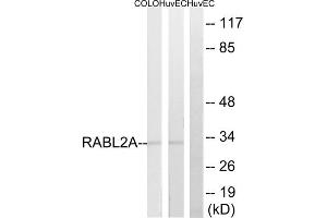 Western blot analysis of extracts from HuvEc, 293 and COLO205 cells, using RABL2A antibody. (RABL2A 抗体  (C-Term))