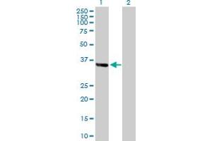 Western Blot analysis of ZNF346 expression in transfected 293T cell line by ZNF346 MaxPab polyclonal antibody. (ZNF346 抗体  (AA 1-294))