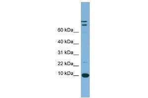 TFF1 antibody used at 1 ug/ml to detect target protein. (TFF1 抗体  (Middle Region))