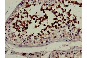Immunohistochemistry (IHC) image for anti-Cytochrome P450, Family 51, Subfamily A, Polypeptide 1 (CYP51A1) (AA 270-437) antibody (ABIN7157910)