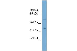 WB Suggested Anti-MGLL Antibody Titration: 0. (MGLL 抗体  (N-Term))