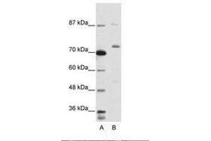 Image no. 2 for anti-Exosome Component 10 (EXOSC10) (C-Term) antibody (ABIN203030) (EXOSC10 抗体  (C-Term))