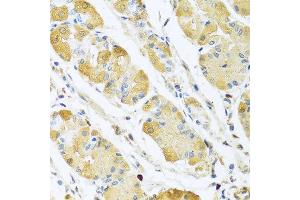 Immunohistochemistry of paraffin-embedded human stomach using C4BPB antibody at dilution of 1:100 (40x lens). (C4BPB 抗体)