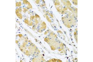 Immunohistochemistry of paraffin-embedded human stomach using C4BPB antibody at dilution of 1:100 (40x lens).