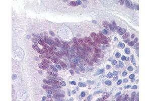 Anti-CDX2 antibody IHC of human small intestine.