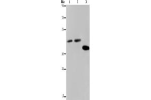 Western Blotting (WB) image for anti-serpin Peptidase Inhibitor, Clade B (Ovalbumin), Member 3 (SERPINB3) antibody (ABIN2423789) (SERPINB3 抗体)