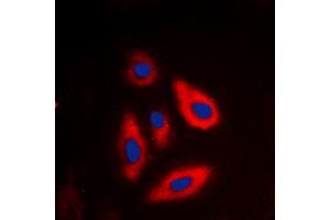 Immunofluorescent analysis of TSC2 (pT1462) staining in SHSY5Y cells. (Tuberin 抗体  (C-Term, pSer1462))