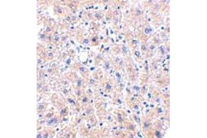 Immunohistochemistry of DRAM in human liver tissue with DRAM polyclonal antibody  at 2. (DRAM 抗体  (C-Term))