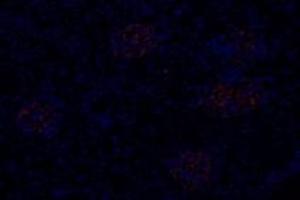 Immunofluorescent analysis of paraformaldehyde-fixed rat kidney using,Slc6a6 (ABIN7075842) at dilution of 1: 600 (TAUT 抗体)