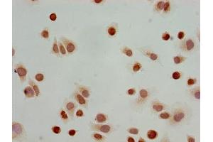 Immunocytochemistry analysis of Hela cells using ABIN7139173 at dilution of 1:100 (HIST1H3A 抗体  (acLys23))