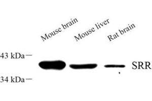 Western blot analysis of srr (ABIN7075554) at dilution of 1: 500 (SRR 抗体)
