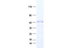 Validation with Western Blot (TADA2L Protein (His tag))