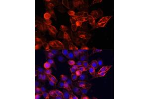 Immunofluorescence (IF) image for anti-CD44 (CD44) (AA 148-247) antibody (ABIN6138193)