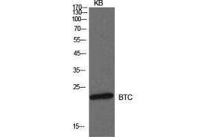 Western Blot (WB) analysis of KB cells using Probetacellulin Polyclonal Antibody. (Betacellulin 抗体  (Internal Region))
