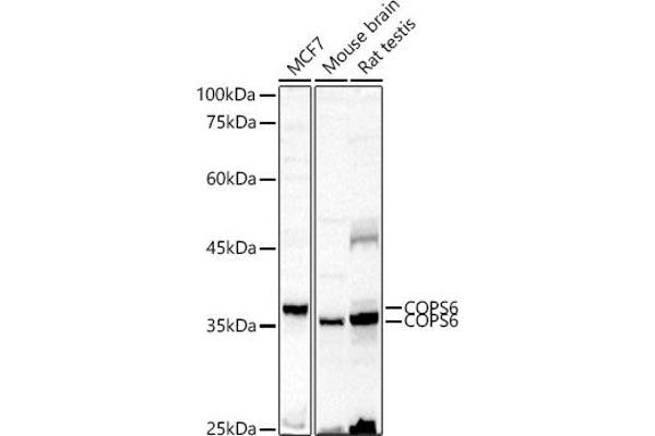 COPS6 抗体  (AA 58-327)