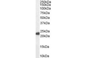 Glutathione Peroxidase 1 抗体  (Internal Region)