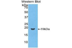 Western Blotting (WB) image for anti-CD59 (CD59) (AA 26-102) antibody (Biotin) (ABIN1174497) (CD59 抗体  (AA 26-102) (Biotin))