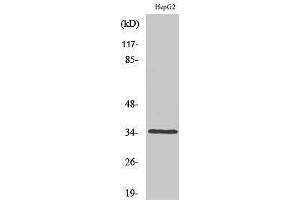 Western Blotting (WB) image for anti-Caspase 6, Apoptosis-Related Cysteine Peptidase (CASP6) (Ser1981) antibody (ABIN3179905) (Caspase 6 抗体  (Ser1981))
